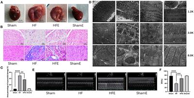 Exercise-Generated β-Aminoisobutyric Acid (BAIBA) Reduces Cardiomyocyte Metabolic Stress and Apoptosis Caused by Mitochondrial Dysfunction Through the miR-208b/AMPK Pathway